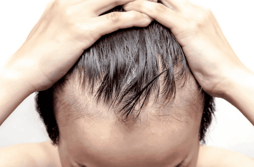 Can Dry Scalp Cause Hair Thinning