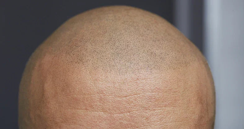 What Does a Hair Tattoo Cost in Orange County?