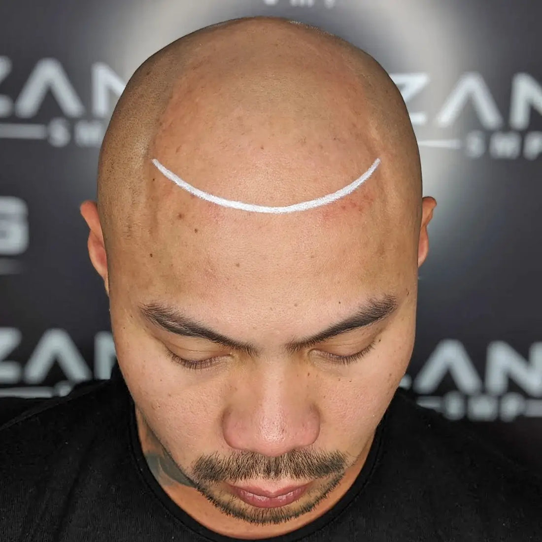 What Is A Micropigmentation Specialist?