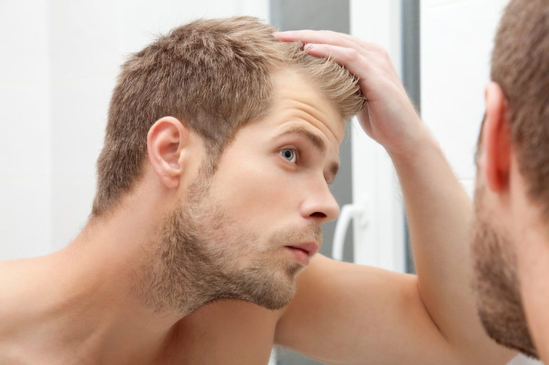 Navigating Hair Loss in Your Early Twenties