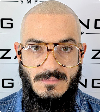 Get Your Confidence Back with
Zang SMP for Hair Loss