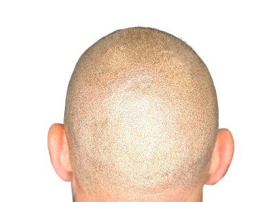 botched_mobile