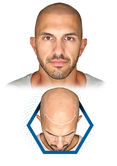 Home page banner image