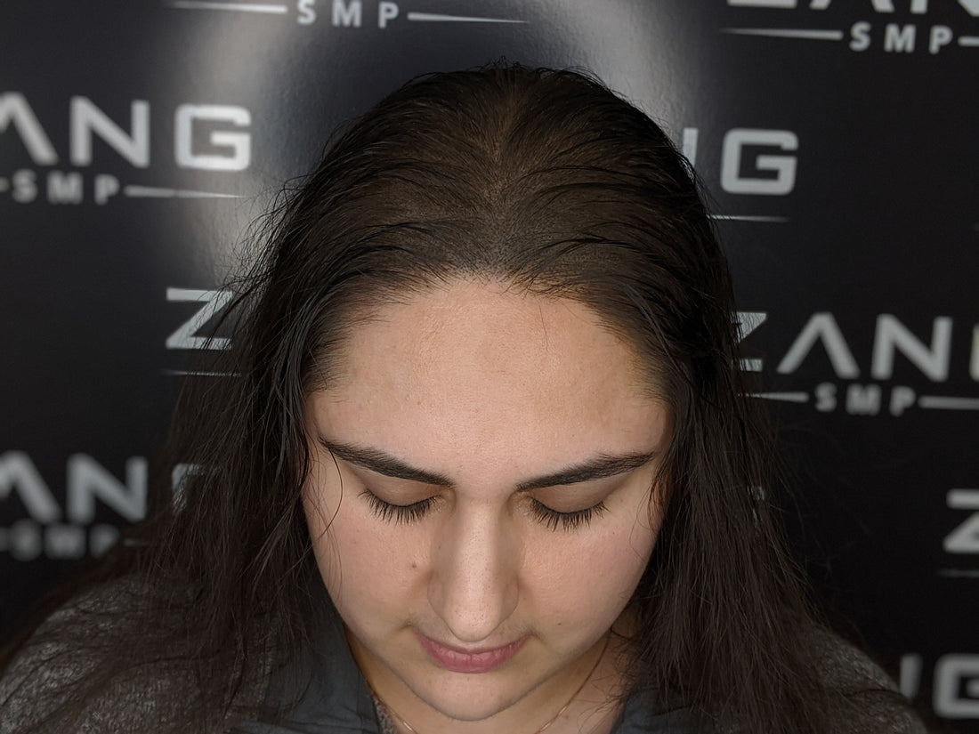 Female client of Zang SMP receiving Scalp Micropigmentation services from Zang SMP.