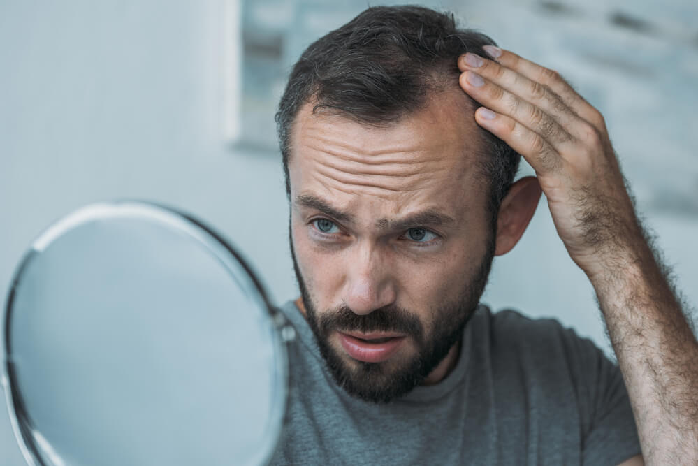 The Impact of Stress on Hair: Exploring Solutions for Thinning