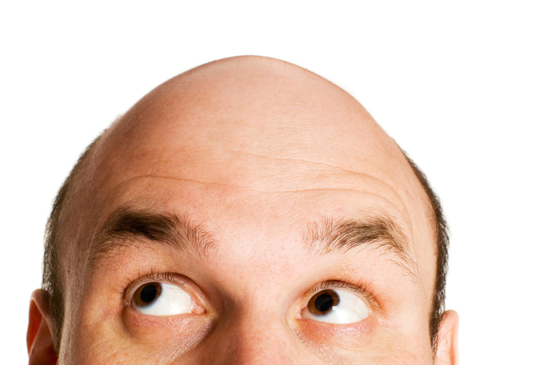 Understanding Potential Side Effects of Scalp Micropigmentation