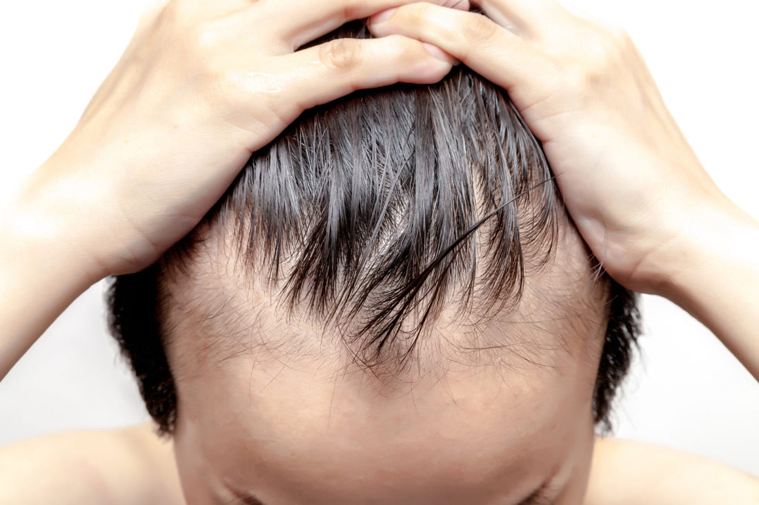 Non-Surgical Hair Solutions for Alopecia: A Guide