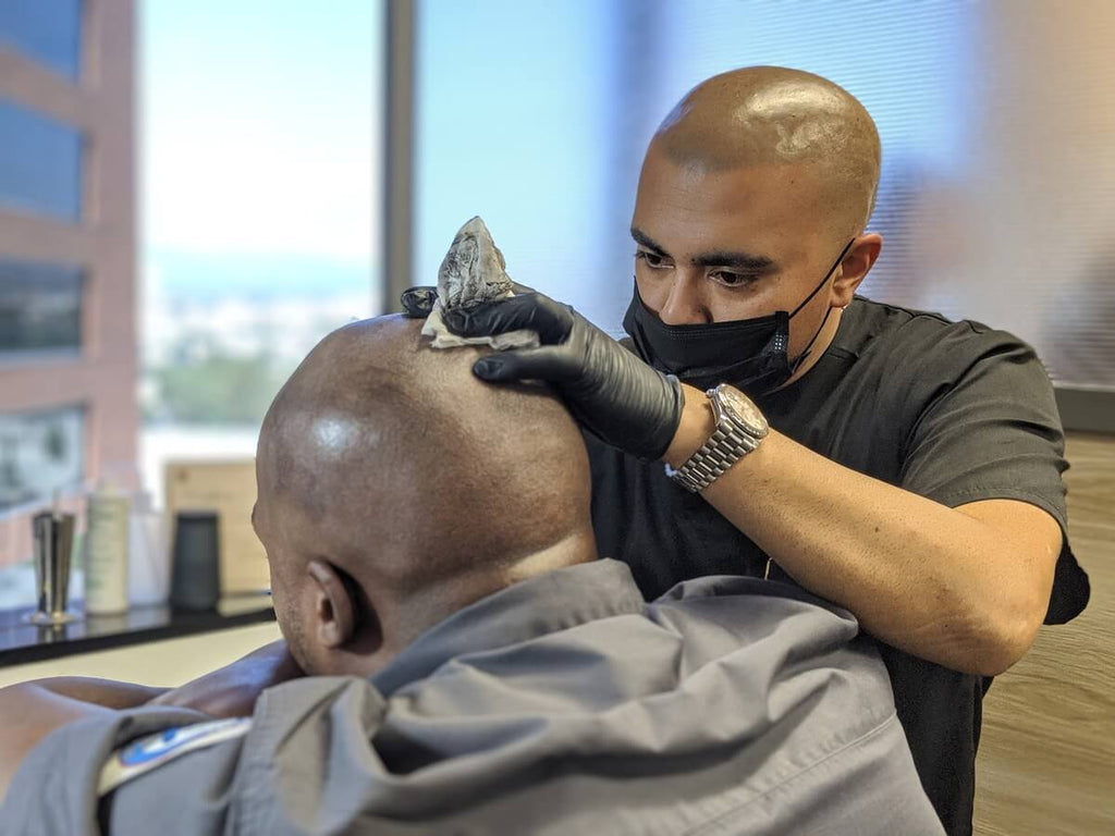 How Long Does Scalp Micropigmentation Take?