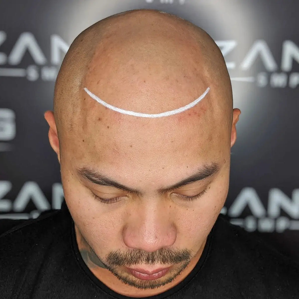 What Is A Micropigmentation Specialist?