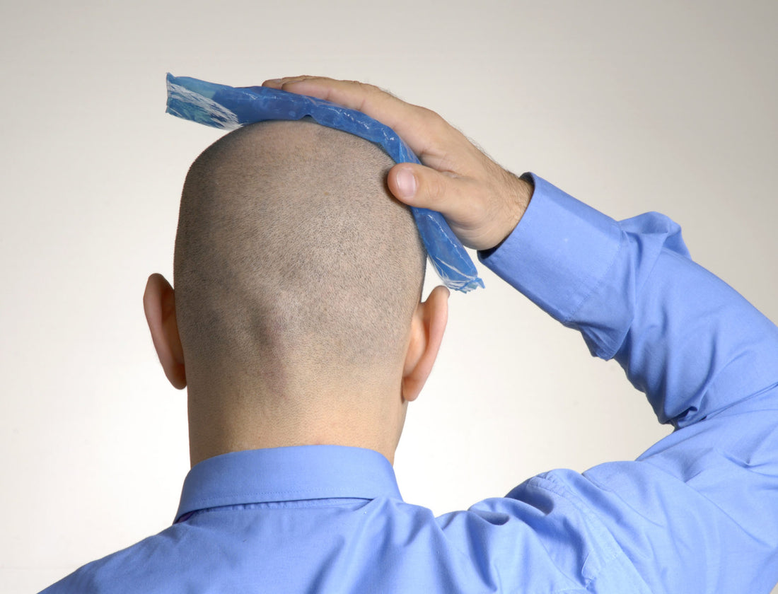 On the Verge of a Cure: The Latest in Baldness Research