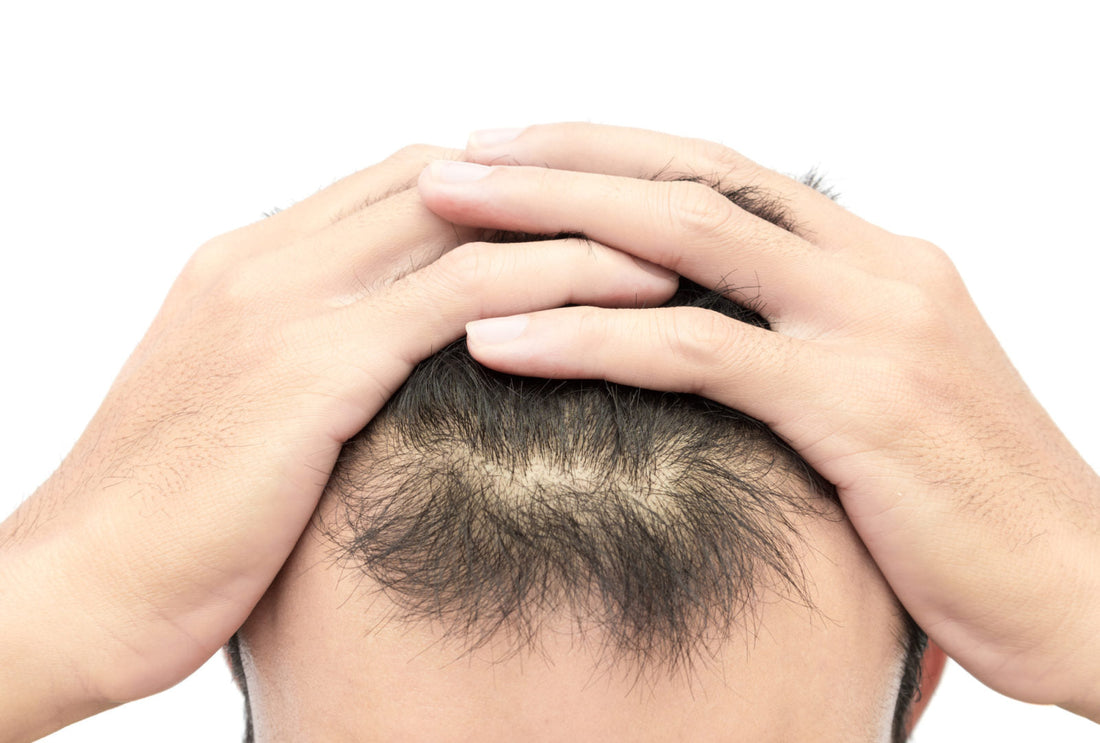 5 Surprising Everyday Habits That Could Be Causing Your Hair Loss