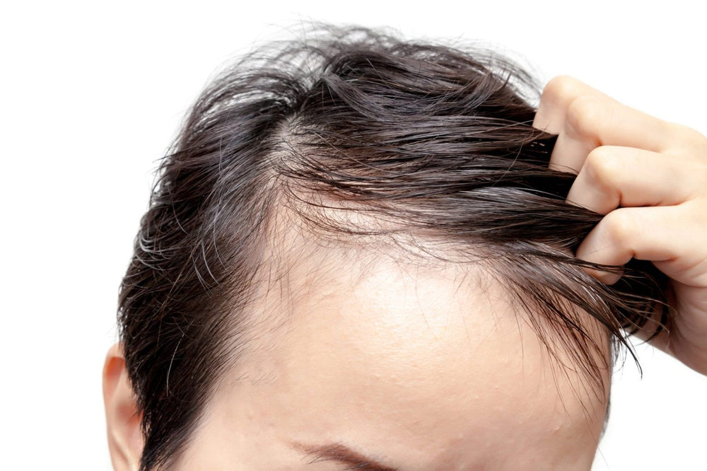 Minoxidil And Finasteride A Comparative Guide For Hair Loss Zang Smp