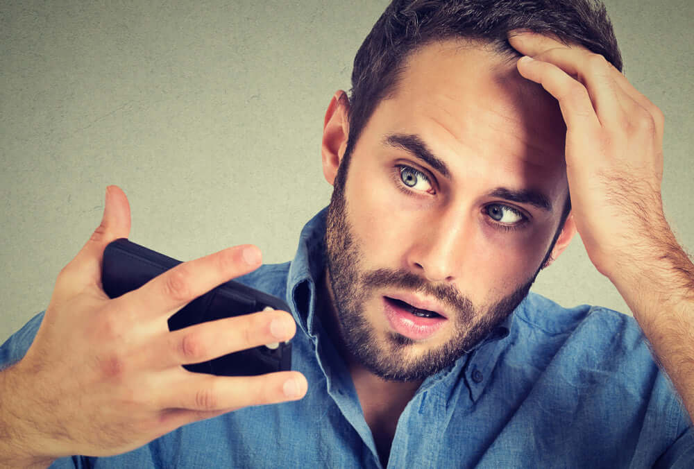 Spotting the Early Signs of Male Pattern Baldness