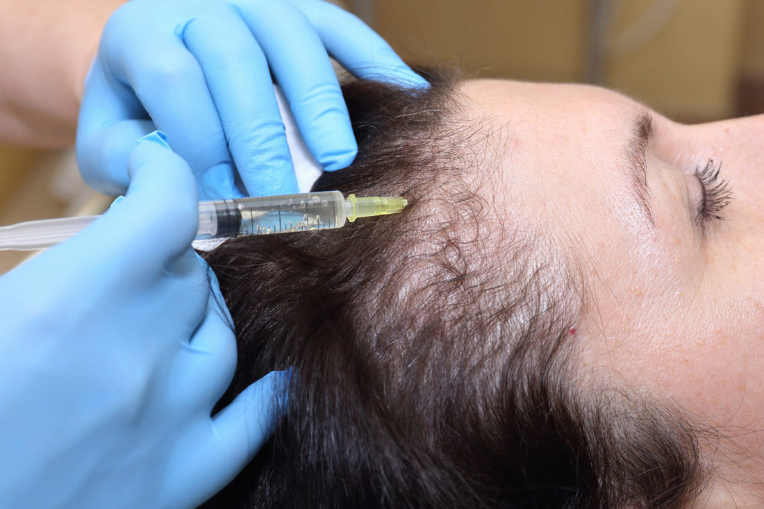 Top Reasons Why Scalp Micropigmentation Is Your Go-To Hair Solution