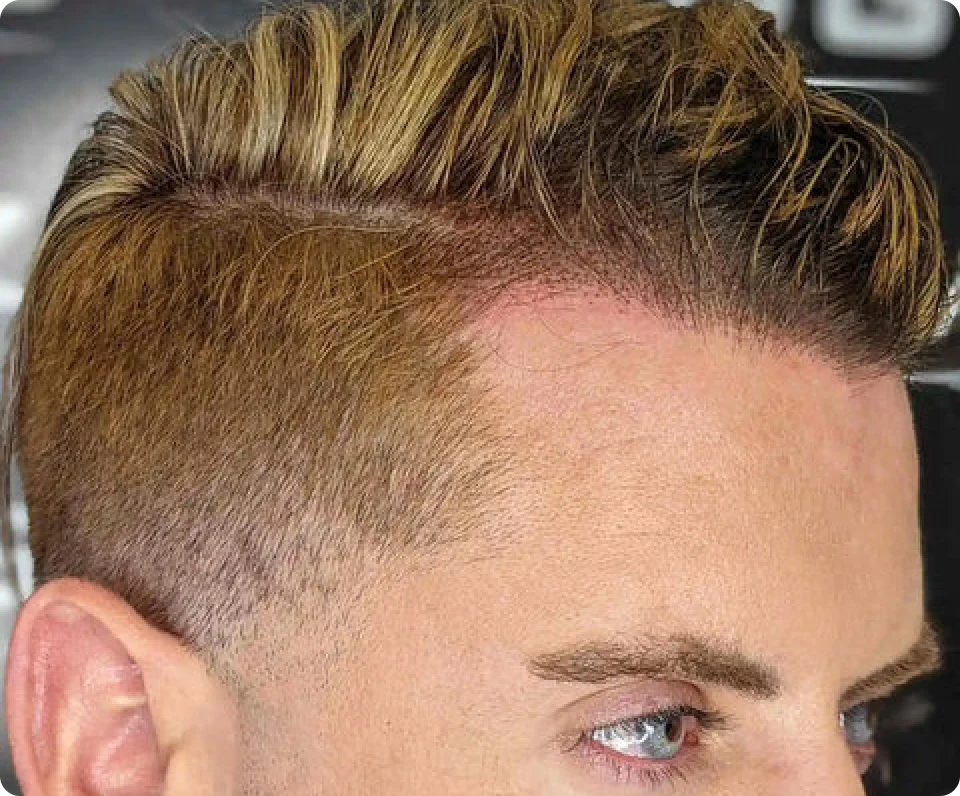Custom_Color_Matching_to_Ensure_a_Natural_Look