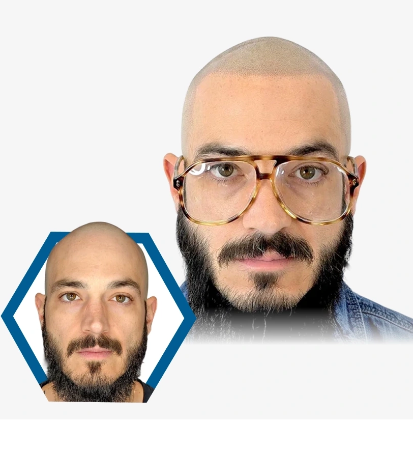 <p>Banner Image</p>