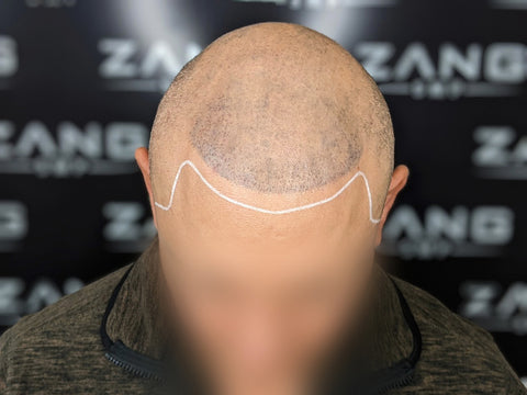 Bald Guy Gets A Hair Tattoo - YouTube
