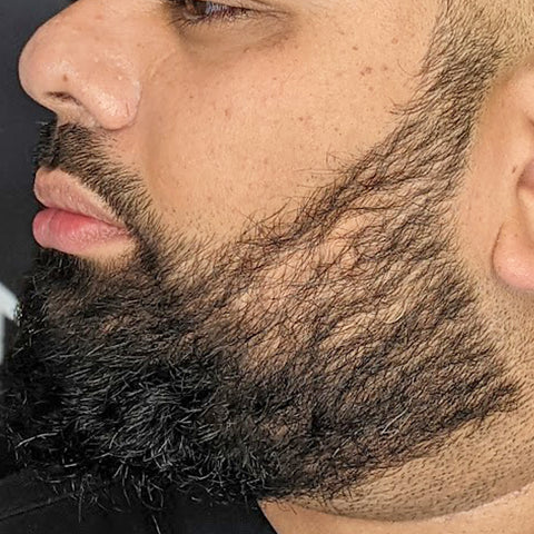 beard